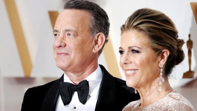 Amerikalı Ünlü Oyuncu Tom Hanks, eşinin ve kendisinin testlerinin pozitif çıktığını açıkladı!