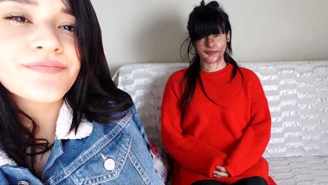 Yüzüne asit döken sevgilisini affeden Berfin Özek konuştu: Ozan’a hakkımı helal ettim