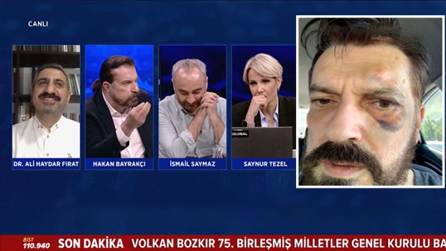 Anketçi Hakan Bayraktar’dan 1 yıl sonra gelen itiraf: Teke tek çağırdım, 5 kişi gelip saldırdılar