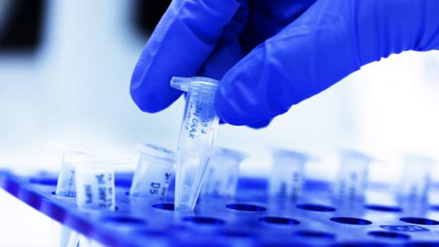 Yurtdışına çıkacaklar 110 TL’ye PCR testi yaptırabilecek