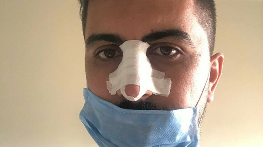 Hasta yakını, sosyal mesafe uyarısı yapan hemşirenin burnunu kırdı!