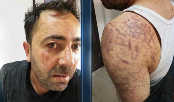 Iğdır Belediye Başkan Yardımcısına Yunanistan sınırında işkence