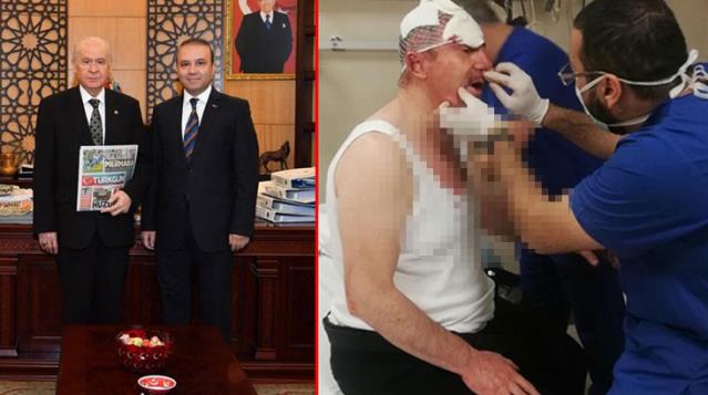Bahçeli’nin Basın Danışmanı Yıldıray Çiçek: Üç yumruk için ortalığı ayağa kaldırıyorlar