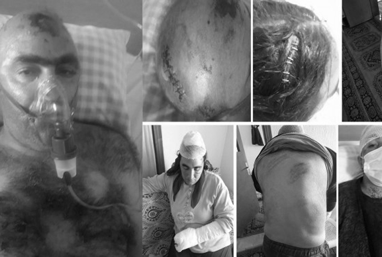 Irkçı saldırganlara hem tahliye hem koruma