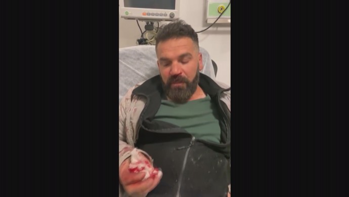 İddiaya göre; Ağrı Belediye Başkanı Savcı Sayan korumaları işçileri darp etti