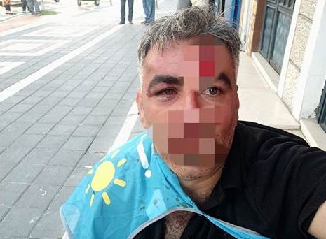 Esenyurt’ta İYİ Partililere saldırı: 2 kişi yaralandı