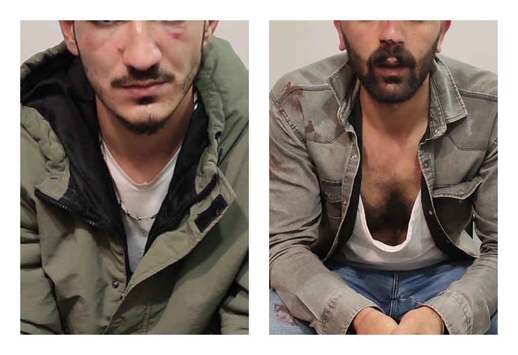Sokak müzisyeni Cihan Aymaz’ın katledilmesine tepki gösteren iki kişi karakolda işkenceye uğradı