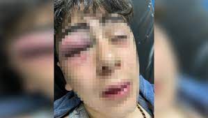 Çocuğa işkence eden 3 polisin tahliyesine Diyarbakır Barosu’ndan tepki