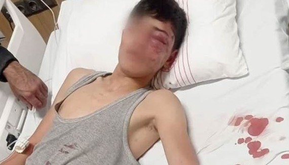 Antep’te Suriyeli çocuk darp edildi