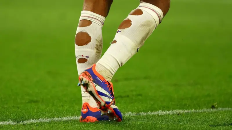 EURO 2024 finalisti İngiltere’nin futbolcularının çorapları neden delik deşik?